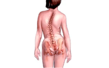 motivele dezvoltării osteocondrozei cervicale