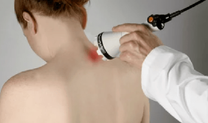tratamentul osteocondrozei cervicale prin metode de fizioterapie