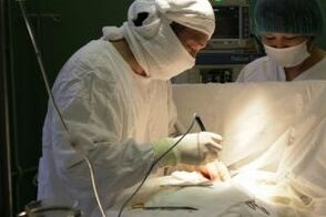Tratamentul chirurgical al artrozei articulației genunchiului