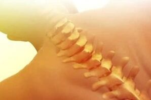 osteocondroza cum se trateaza